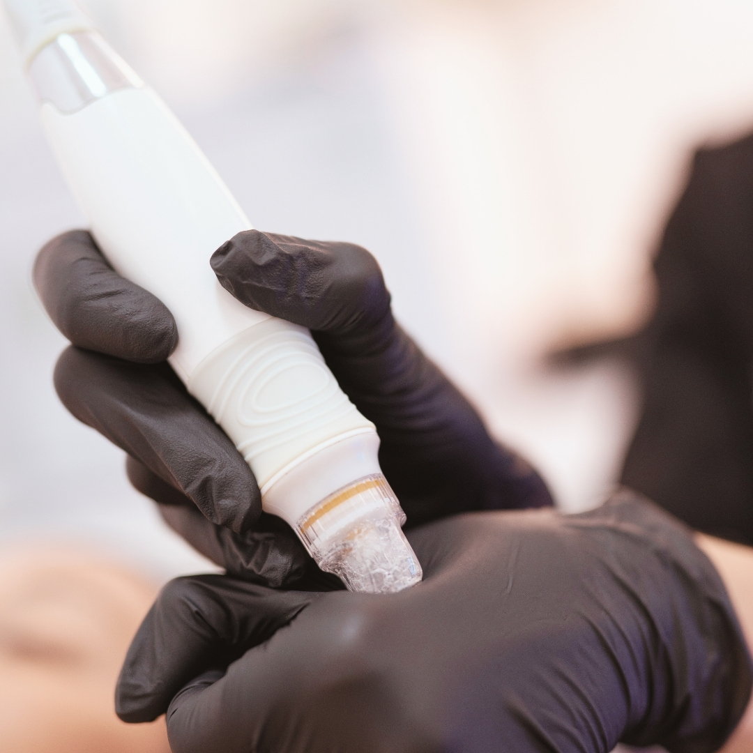 hidromicrodermoabrasion-en-valencia-limpieza-facial