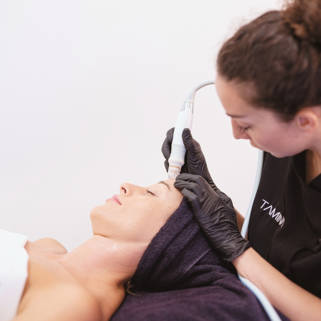 limpieza-facial-dermoabrasion-valencia