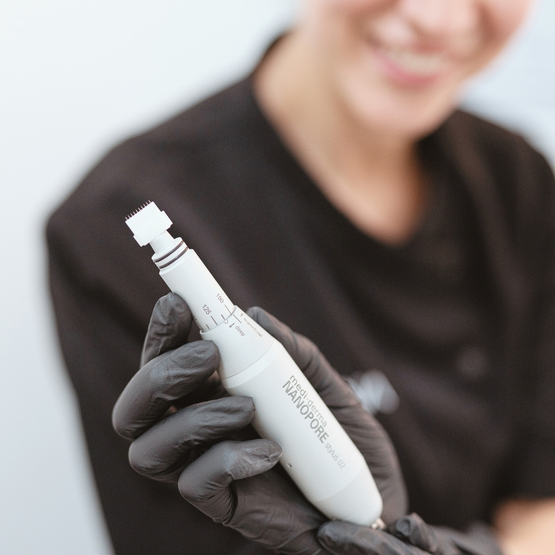 microneedling-valencia-nanopone