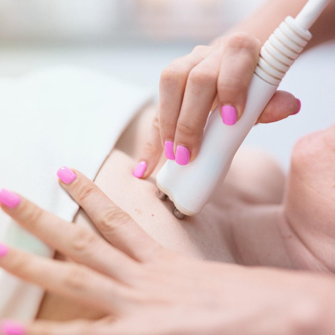 radiofrecuencia-cara-cuello-y-escote