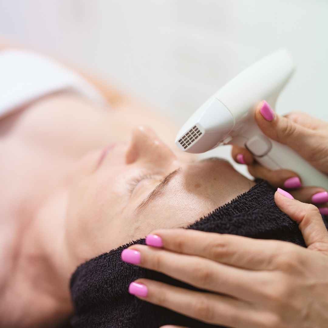 radiofrecuencia-fraccional-rejuvenecimiento