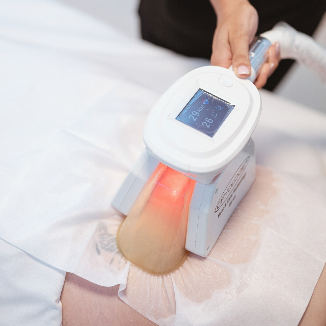 tratamiento-criolipolisis-en-valencia