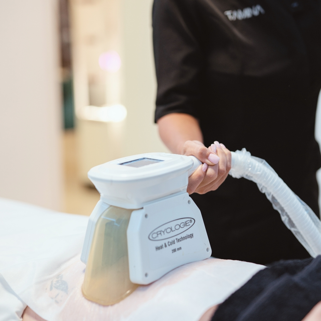 tratamiento-criolipolisis-valencia