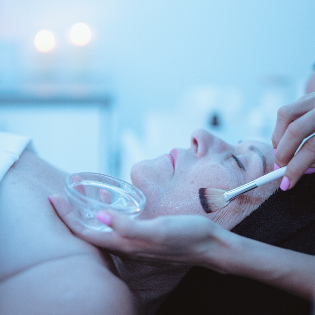 tratamiento-peeling-facial-valencia