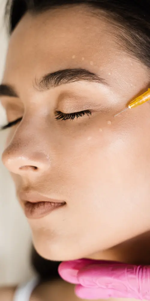 mesoterapias faciales ofertas