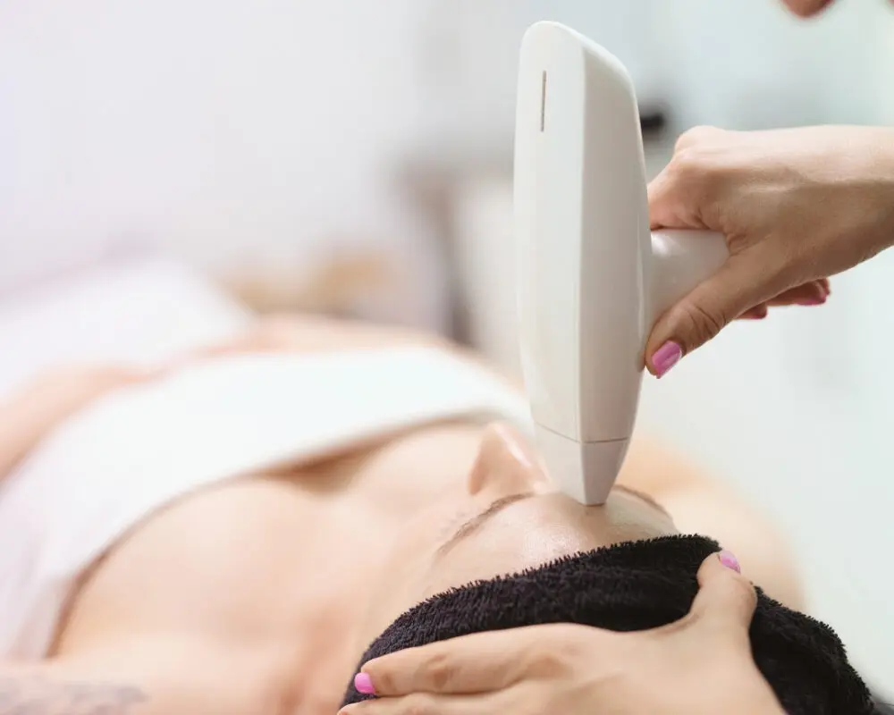 radiofrecuencia facial en valencia
