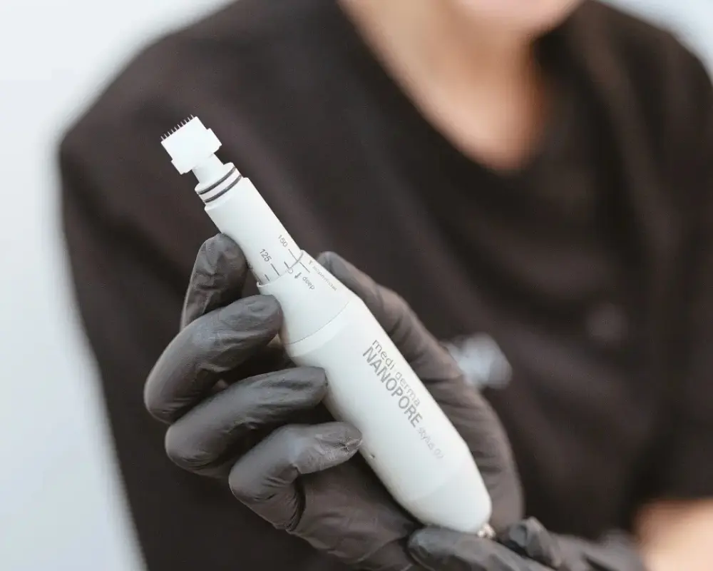 tratamientos manchas acne en valencia