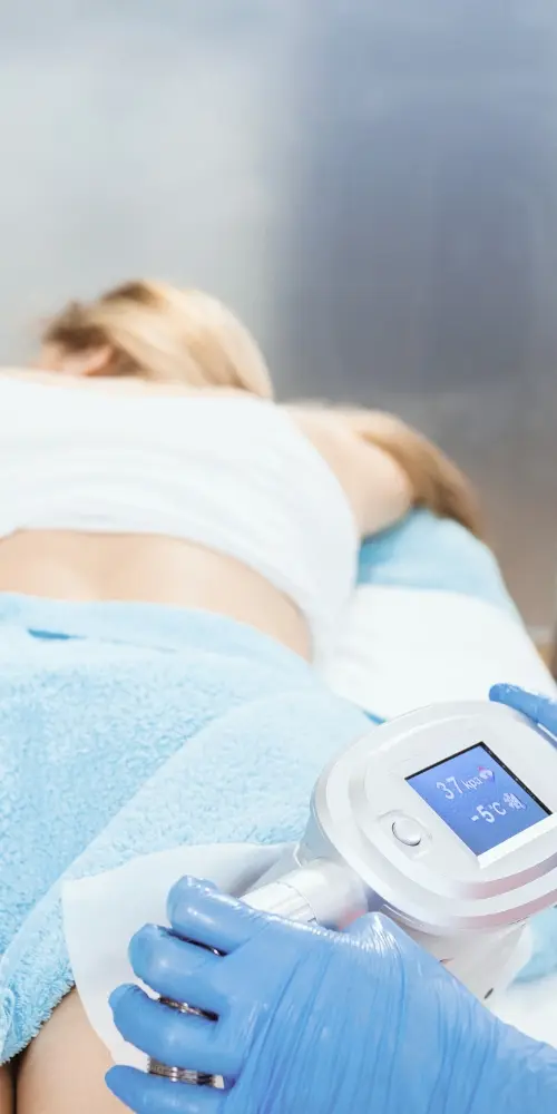 coolsculpting valencia
