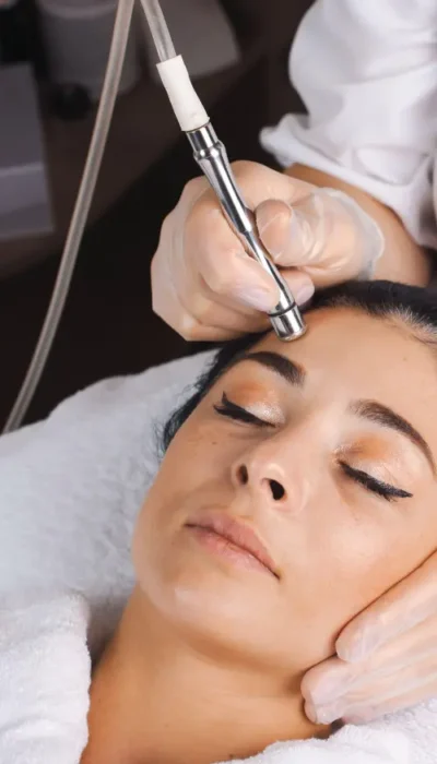 peeling quimico facial valencia